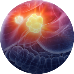 Microwave Ablation